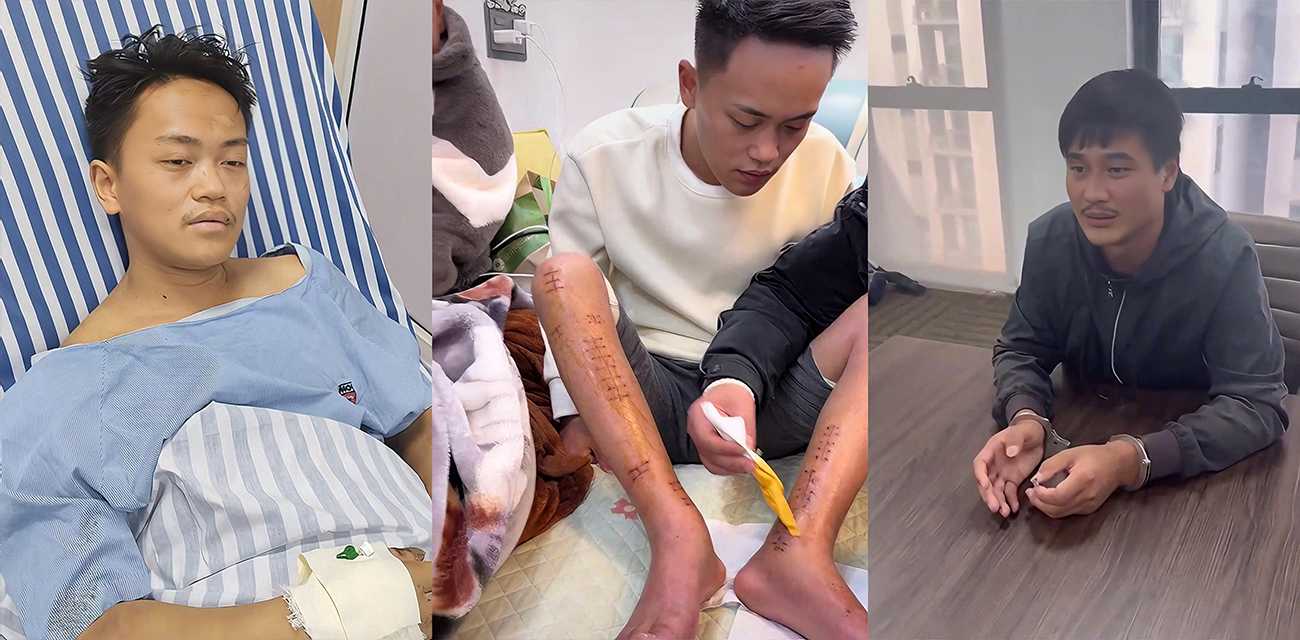 蓝战非事件再现！知名网红 非洲洋洋 诱骗博主曾凡贵网诈国人 反抗竟遭虐待打断双腿！