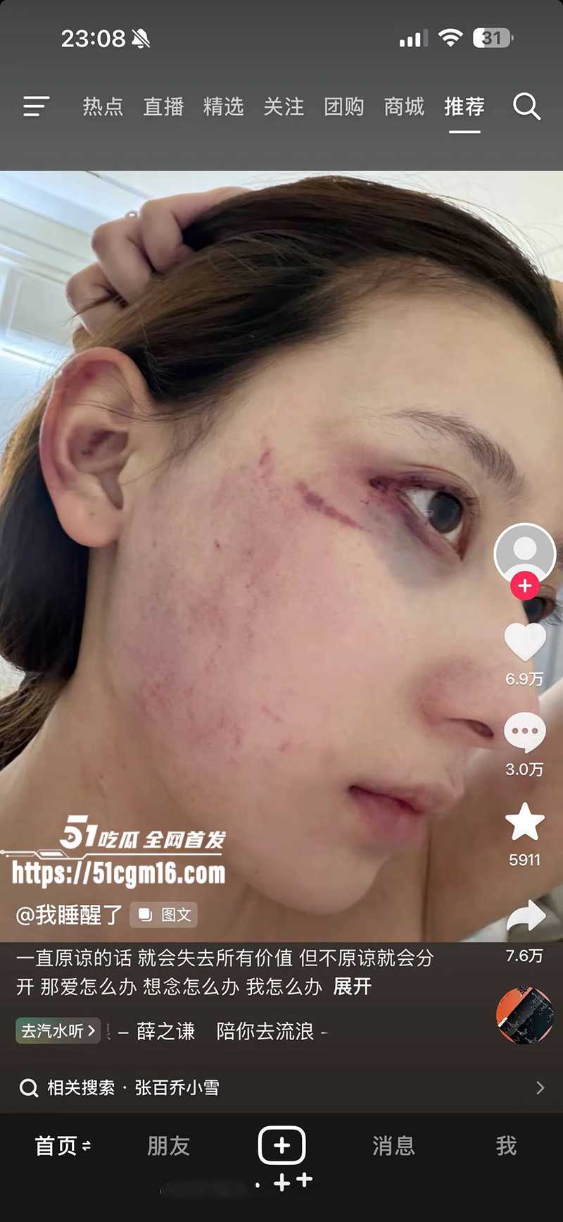 千万大V张百乔家暴视频被扒 27 拷贝 千万大V张百乔家暴视频被扒 27 拷贝