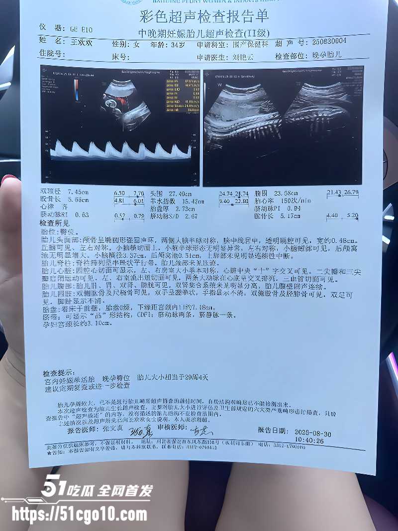 河北顺平母狗王欢约炮诬告对方强奸 4 河北顺平母狗王欢约炮诬告对方强奸 4