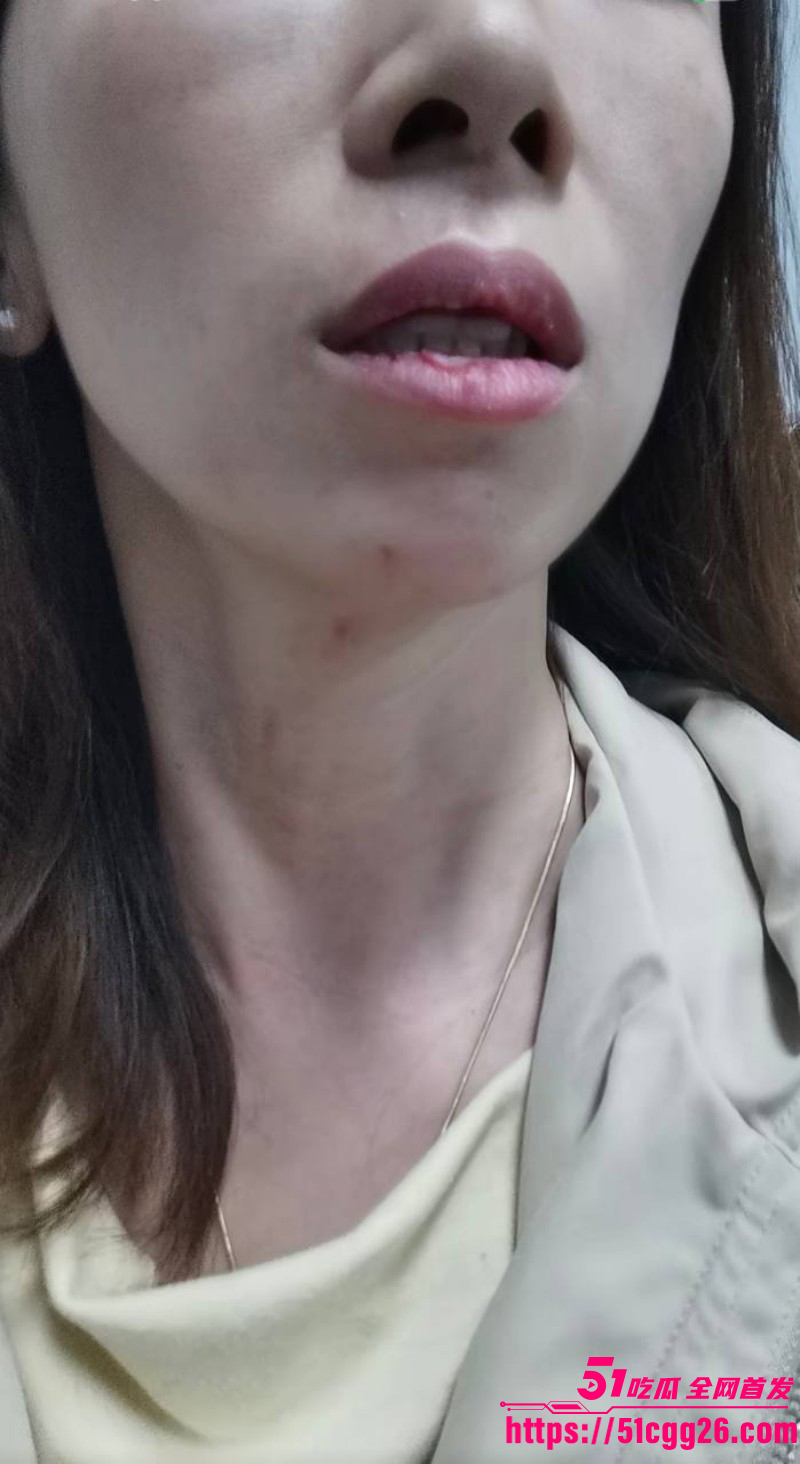 女网红娜姐重生曝光丈夫高飞家暴出轨025 女网红娜姐重生曝光丈夫高飞家暴出轨025