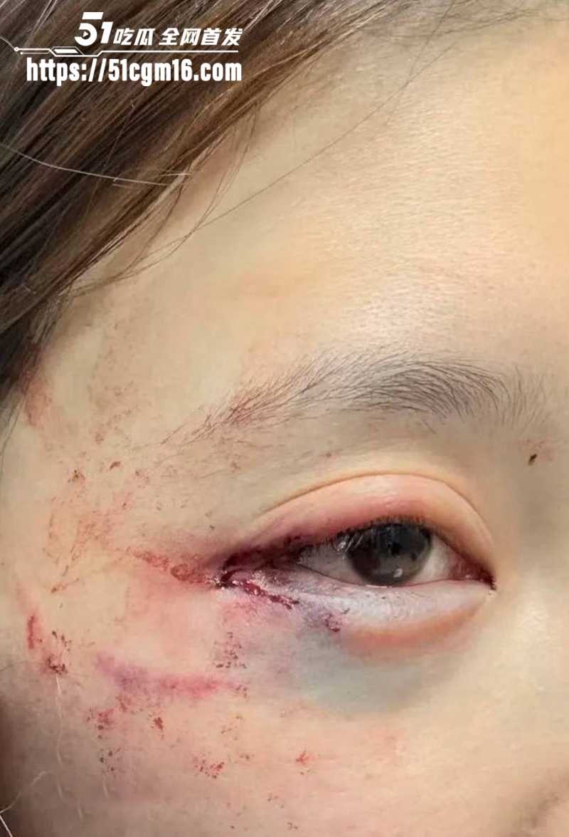 千万大V张百乔家暴视频被扒 32 拷贝 千万大V张百乔家暴视频被扒 32 拷贝