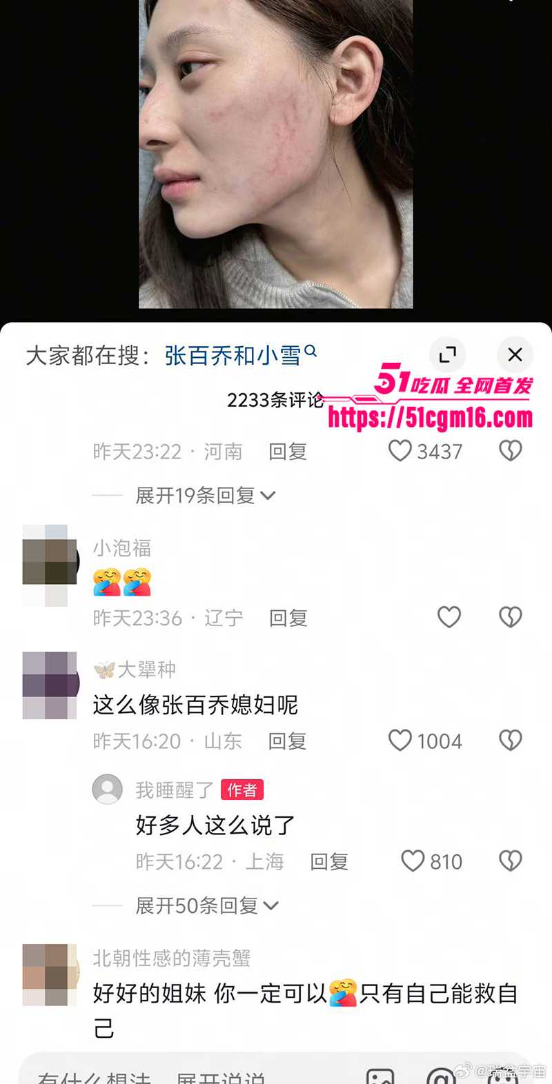 千万大V张百乔家暴视频被扒 24 拷贝 千万大V张百乔家暴视频被扒 24 拷贝