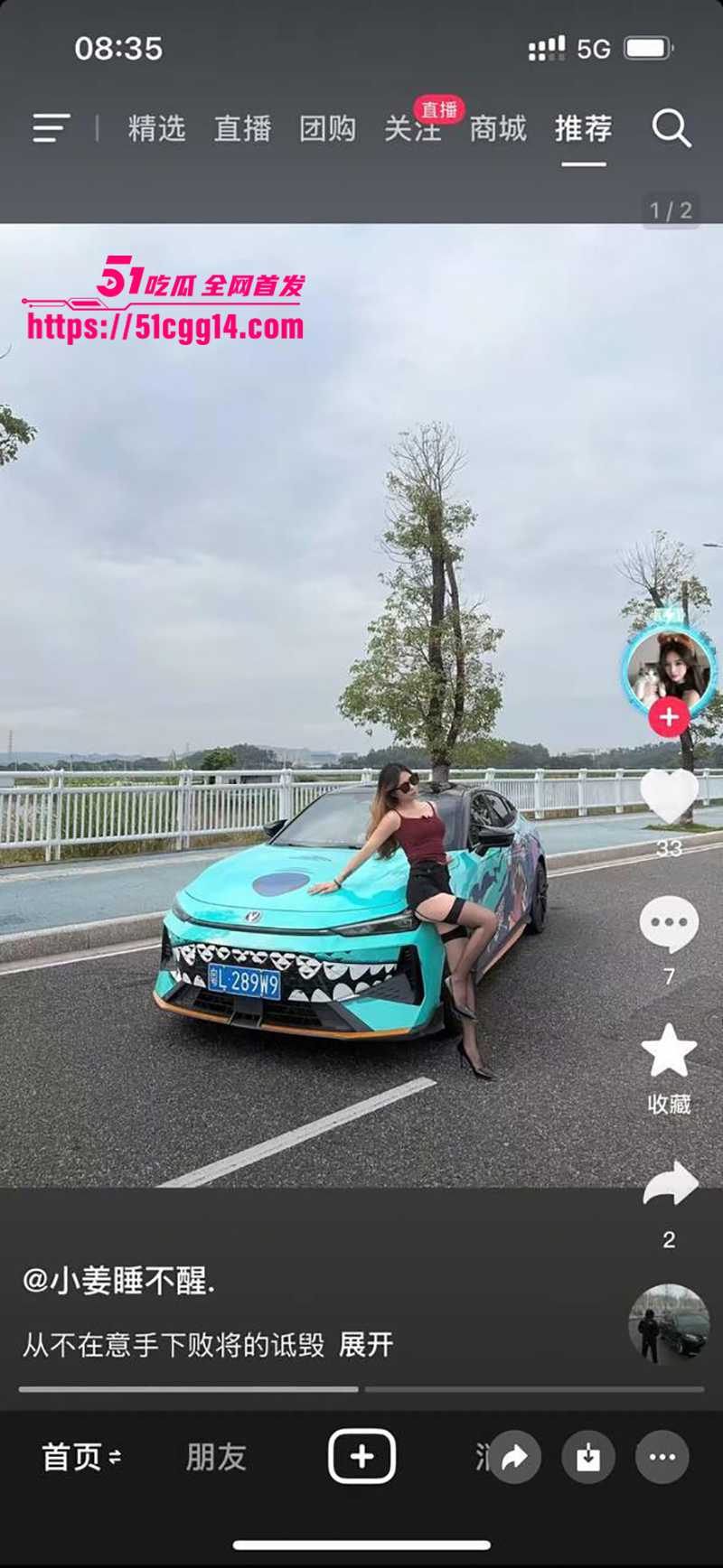 抖音网红小姜睡不醒车祸视频曝光, 8 拷贝 抖音网红小姜睡不醒车祸视频曝光, 8 拷贝