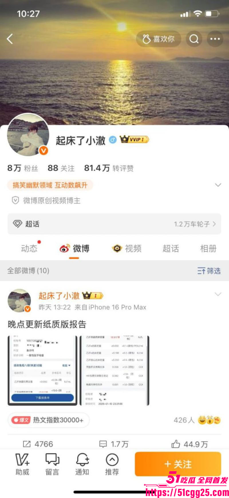 抖音300万粉TS网红起床了小澈直播翻车 2 抖音300万粉TS网红起床了小澈直播翻车 2