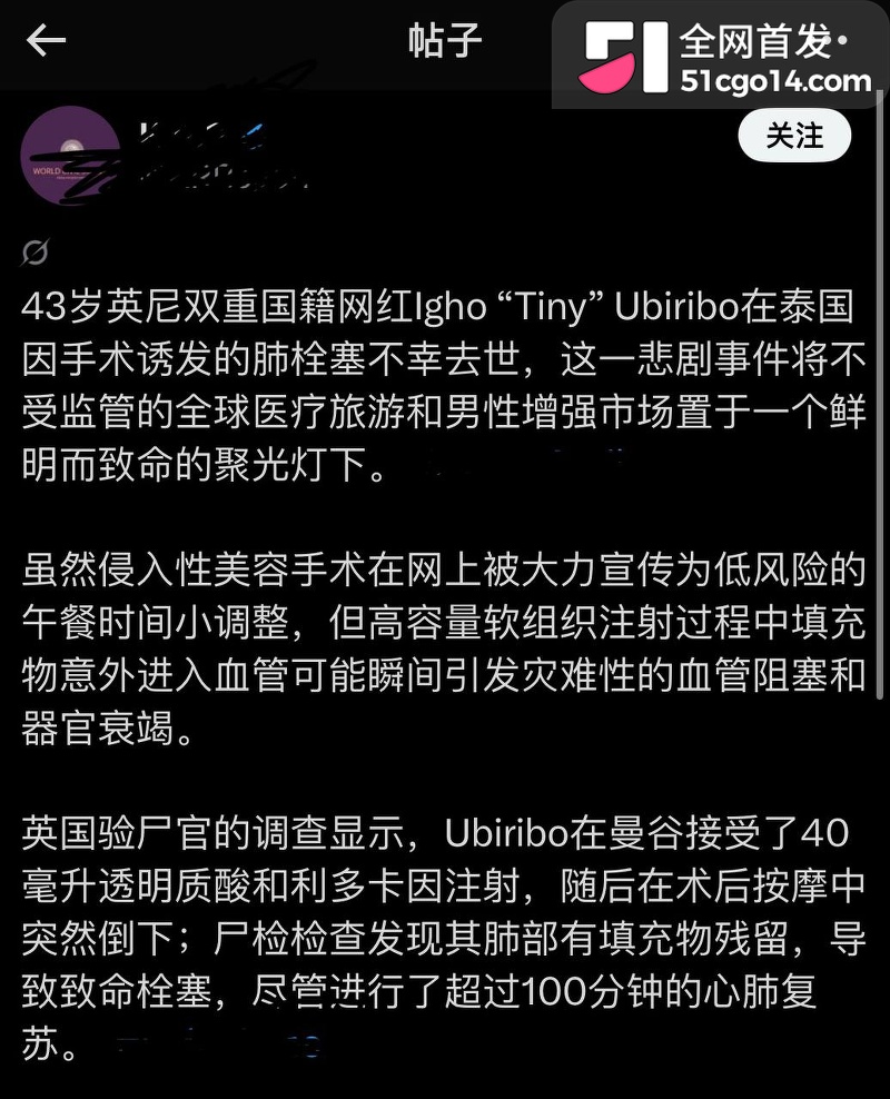 英籍网红 Tiny 13 英籍网红 Tiny 13
