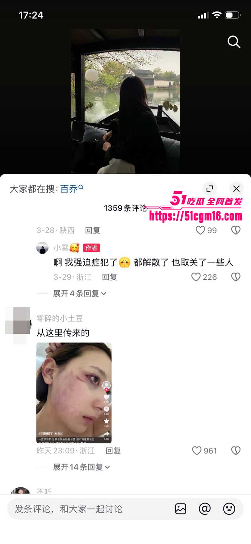 千万大V张百乔家暴视频被扒 18 拷贝 千万大V张百乔家暴视频被扒 18 拷贝