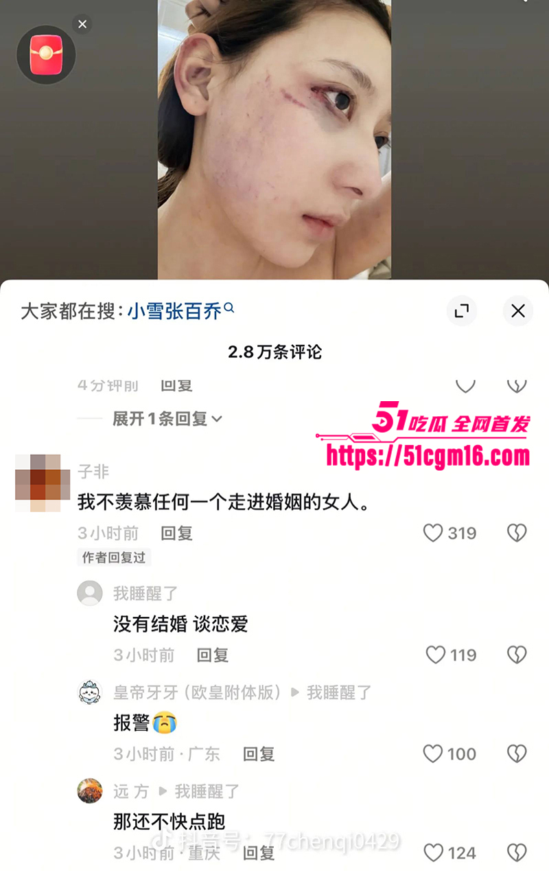千万大V张百乔家暴视频被扒 22 拷贝 千万大V张百乔家暴视频被扒 22 拷贝