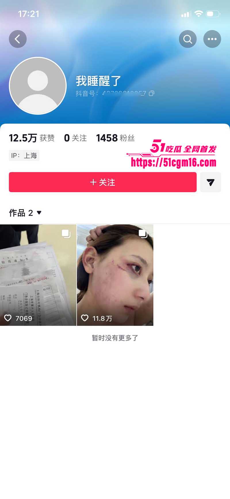 千万大V张百乔家暴视频被扒 1 拷贝 千万大V张百乔家暴视频被扒 1 拷贝