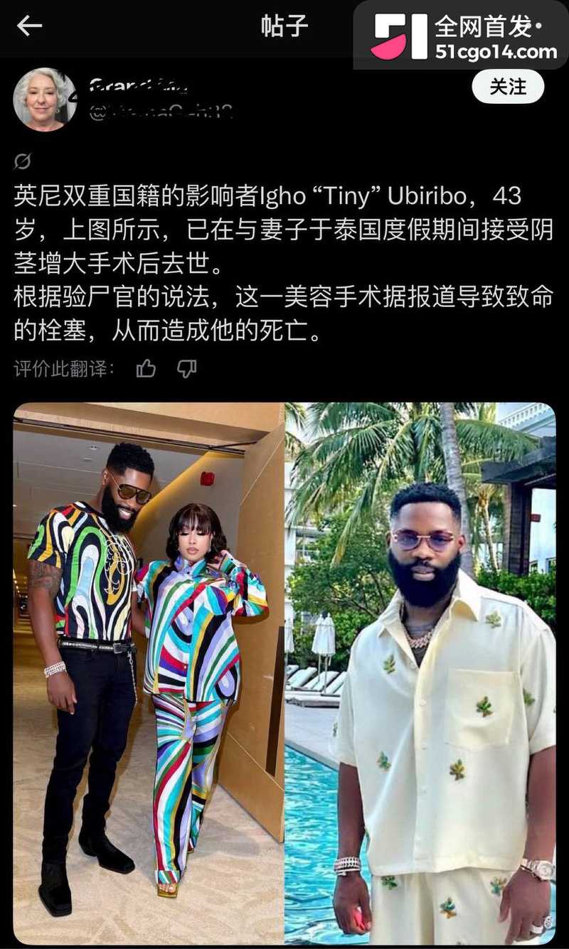 英籍网红 Tiny 8 英籍网红 Tiny 8