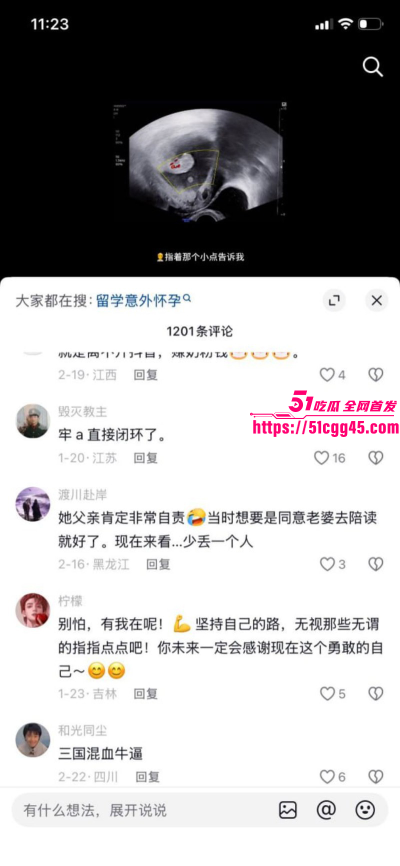 德国留学生攀小宝怀孕回国找接盘侠017 德国留学生攀小宝怀孕回国找接盘侠017