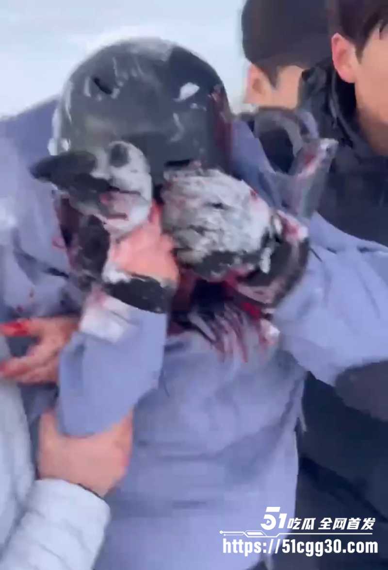 可可托海雪豹咬人视频曝光 3 拷贝 可可托海雪豹咬人视频曝光 3 拷贝