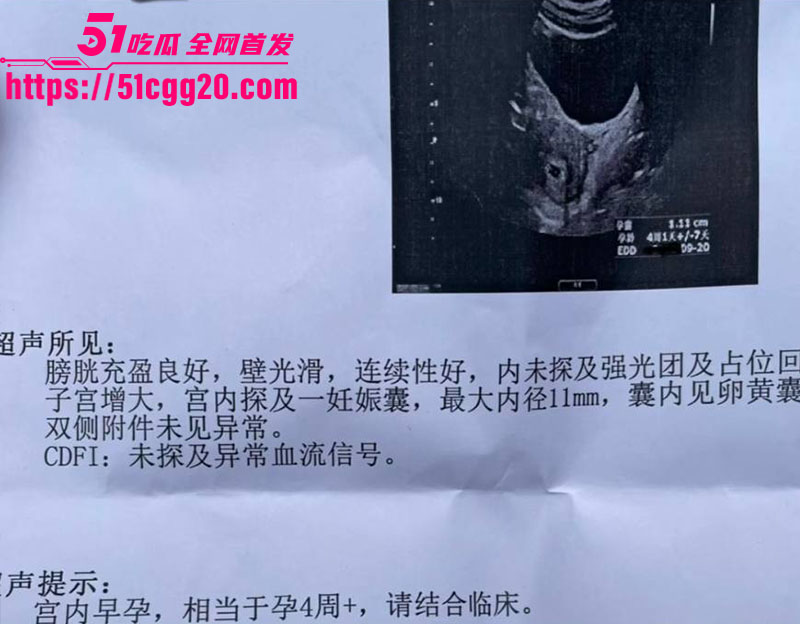 知名演员李沁被爆私生活混乱036 知名演员李沁被爆私生活混乱036