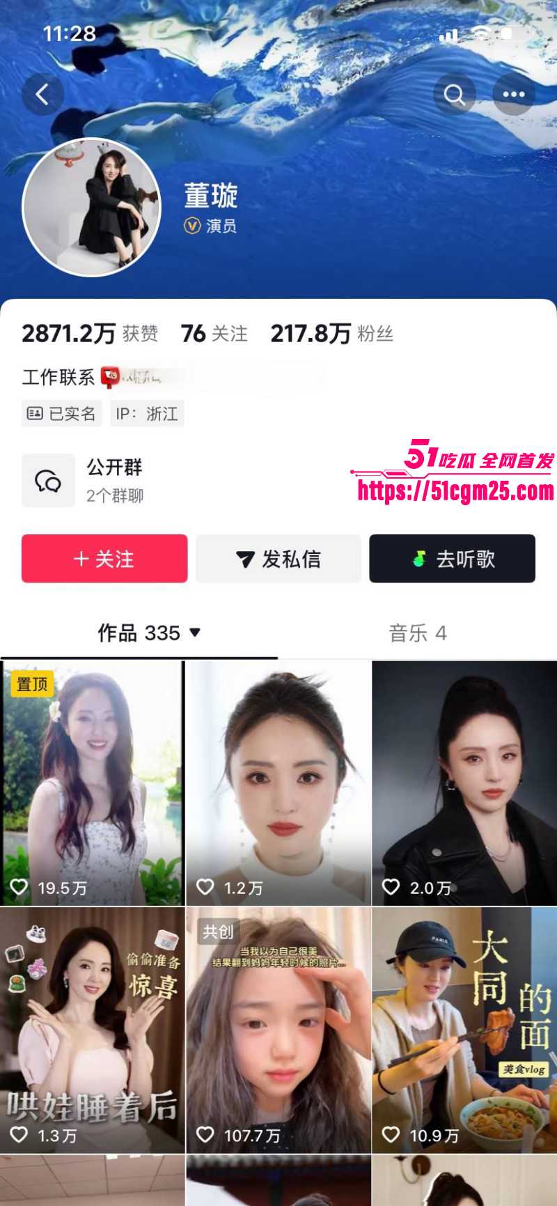张婉婷为劝宋宁峰自曝曾当小三05 张婉婷为劝宋宁峰自曝曾当小三05