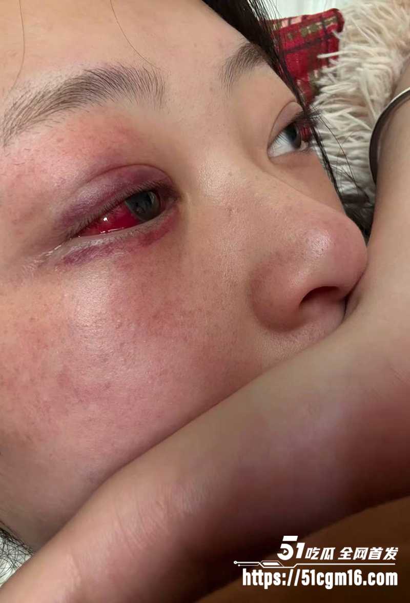 千万大V张百乔家暴视频被扒 30 拷贝 千万大V张百乔家暴视频被扒 30 拷贝