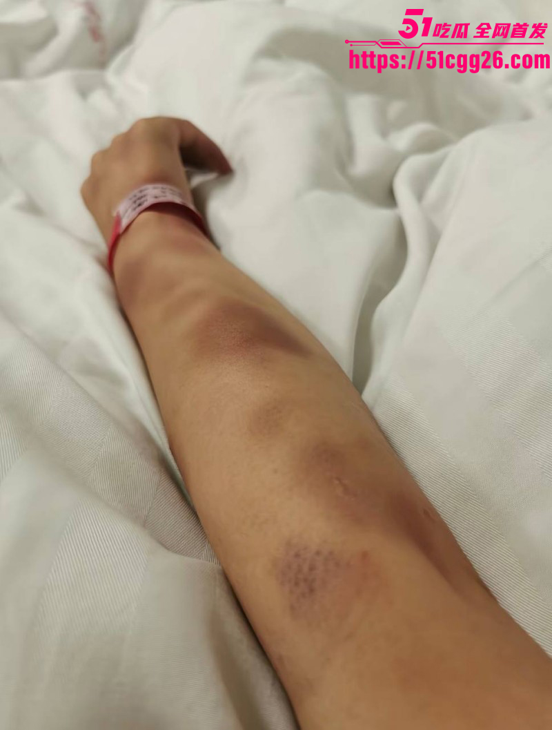 女网红娜姐重生曝光丈夫高飞家暴出轨024 女网红娜姐重生曝光丈夫高飞家暴出轨024