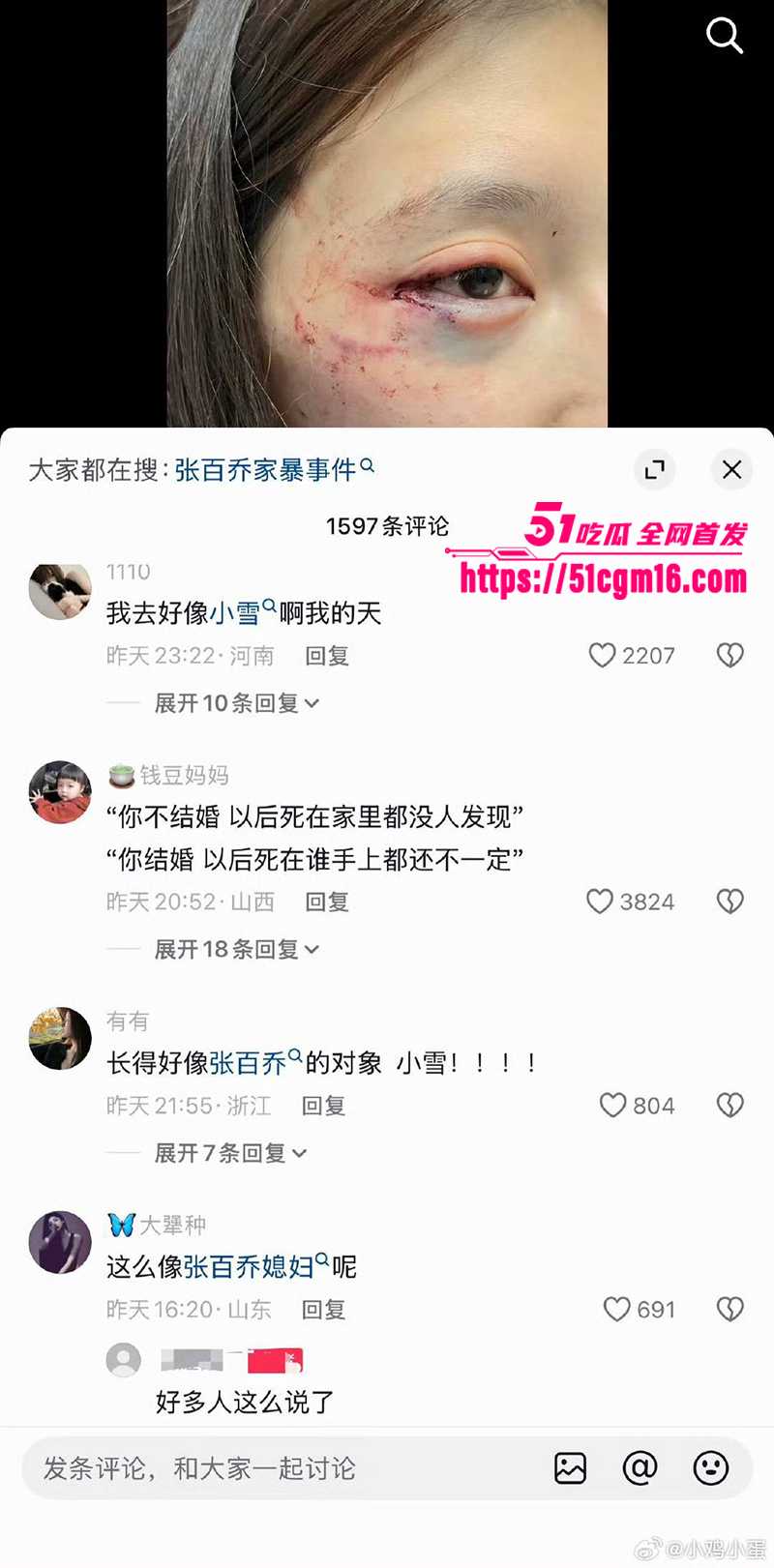 千万大V张百乔家暴视频被扒 23 拷贝 千万大V张百乔家暴视频被扒 23 拷贝