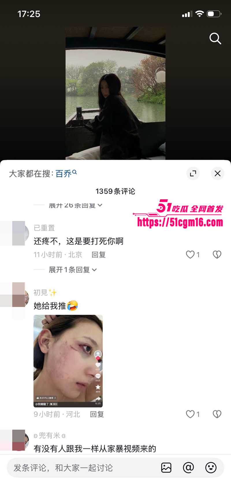 千万大V张百乔家暴视频被扒 20 拷贝 千万大V张百乔家暴视频被扒 20 拷贝