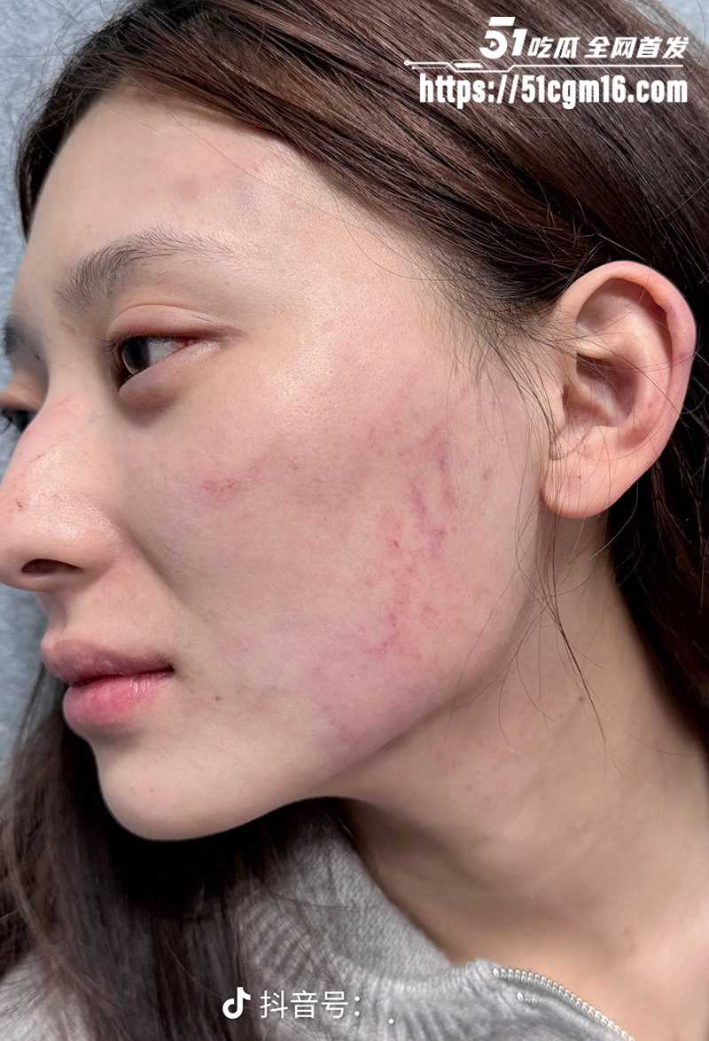 千万大V张百乔家暴视频被扒 31 拷贝 千万大V张百乔家暴视频被扒 31 拷贝